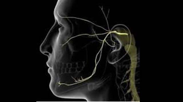 Neuralgia